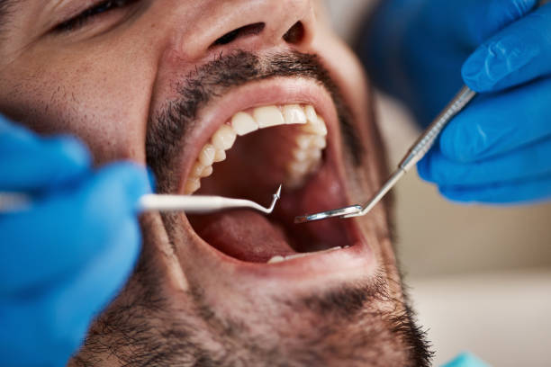 Best Broken or Chipped Tooth Repair in Wanaque, NJ